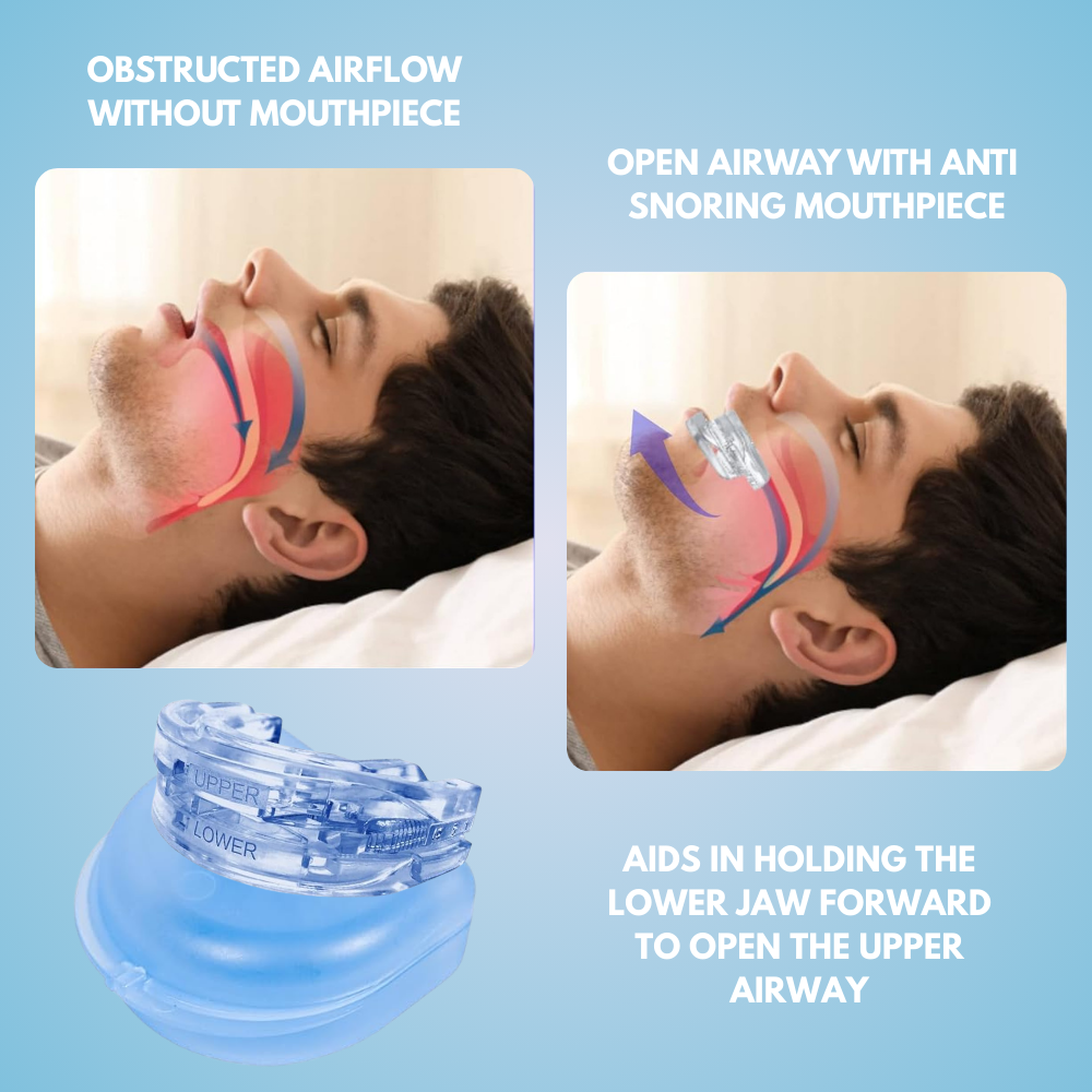 Anti-Snore Mouthpiece