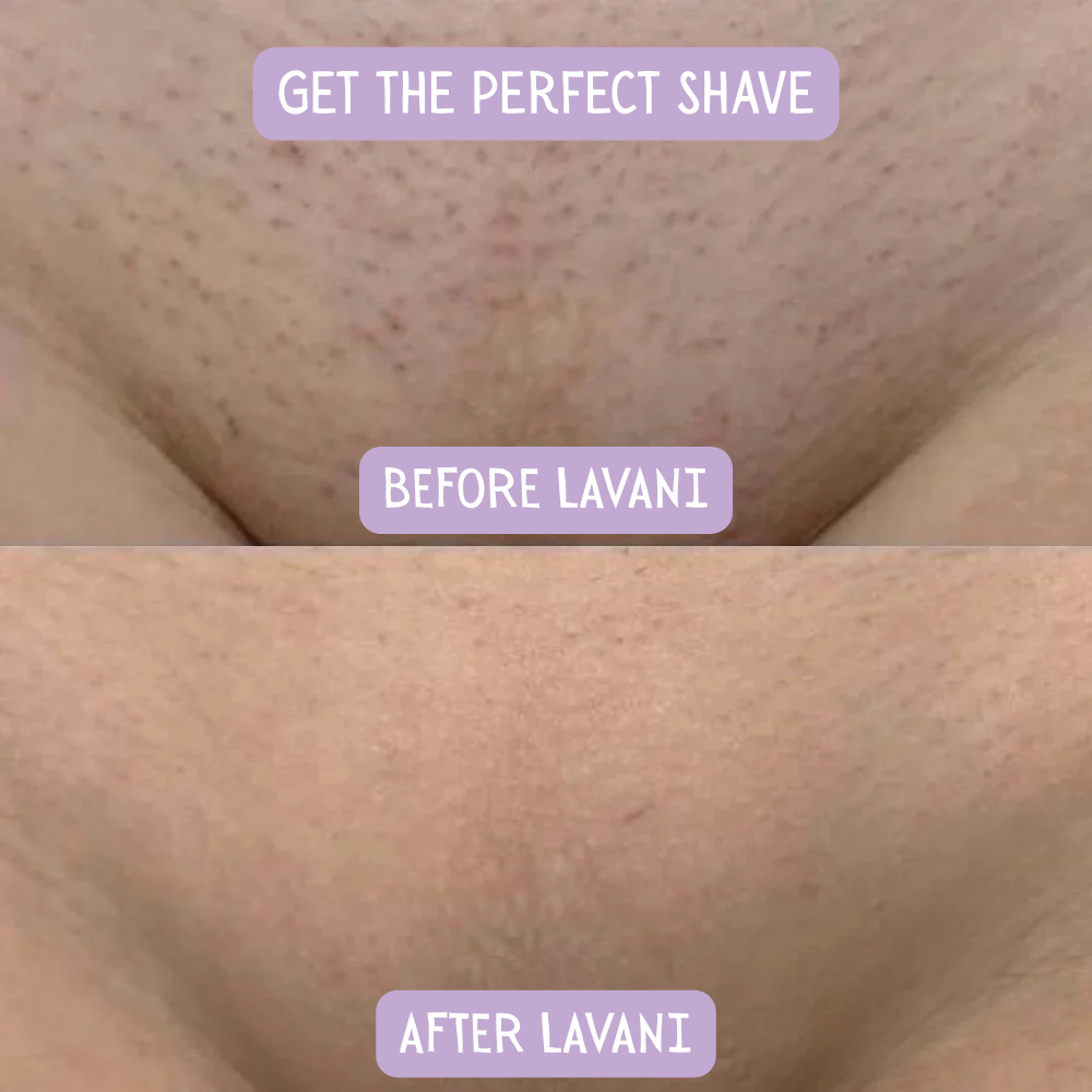 Lavani™ Dual Bikini Shaver